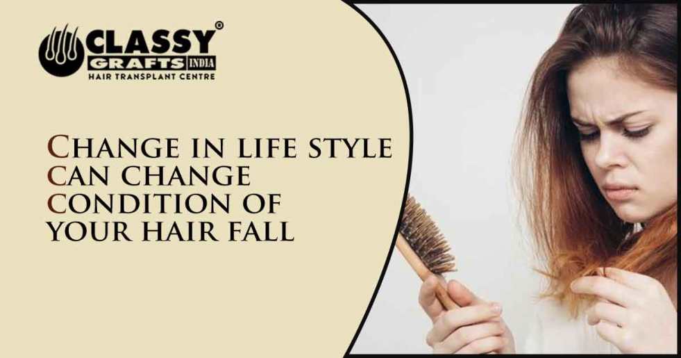 Change In Life Style Can Change Condition Of Your Hair Fall